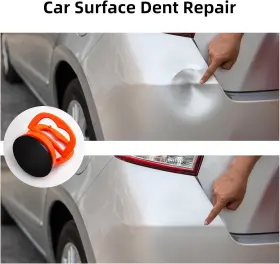 3PC-XP NOEAIKE Dent Puller Suction Cup Pack Removal Paintless #2 3PC-XP NOEAIKE Dent Puller Suction Cup Pack Removal Paintless #2